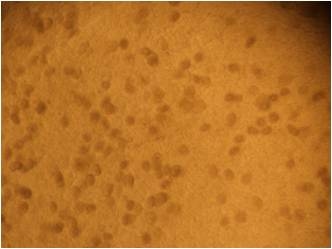La importancia del monitoreo de la coccidiosis - Image 7