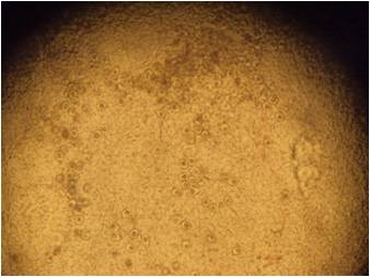 La importancia del monitoreo de la coccidiosis - Image 8