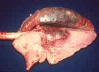 Actinobacillus Pleuropneumoniae: Control - Image 2