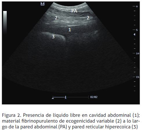 Reticulopericarditis traumática: reporte de un caso - Image 2