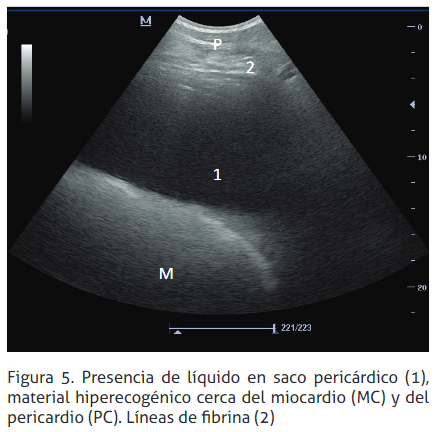 Reticulopericarditis traumática: reporte de un caso - Image 5
