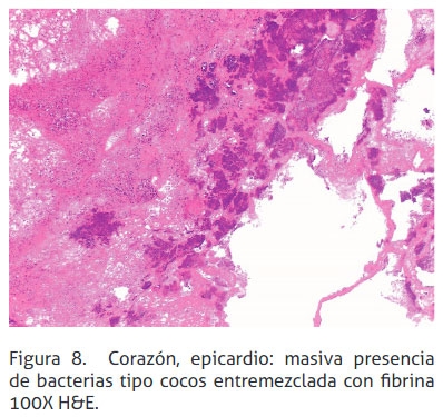 Reticulopericarditis traumática: reporte de un caso - Image 8