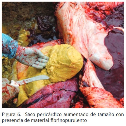 Reticulopericarditis traumática: reporte de un caso - Image 6