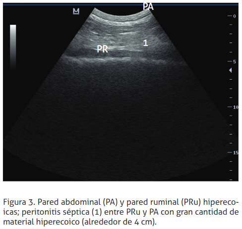 Reticulopericarditis traumática: reporte de un caso - Image 3