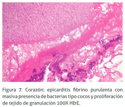 Reticulopericarditis traumática: reporte de un caso - Image 7
