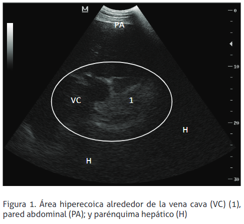 Reticulopericarditis traumática: reporte de un caso - Image 1