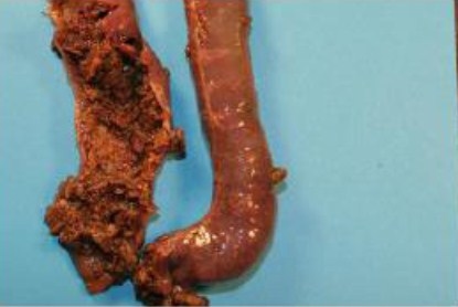 Solución microbiana activa CloSTAT™ - una herramienta de control de la enteritis necrótica clínica y subclínica en la avicultura - Image 1