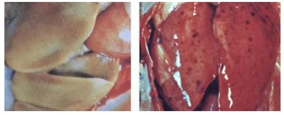 Las funciones de ácidos biliares para proteger la salud del hígado e intestino - Image 1