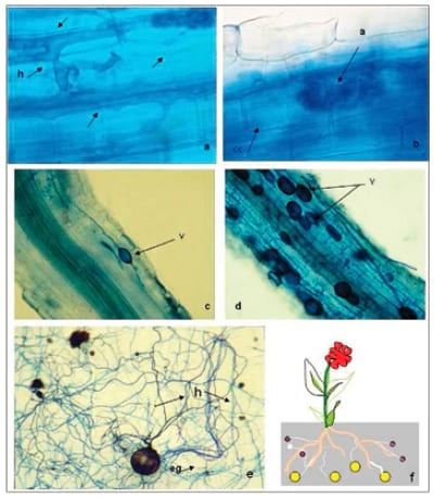 La micorriza arbuscular (MA) centro de la rizosfera: comunidad microbiológica dinámica del suelo - Image 1