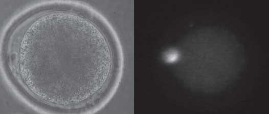 Efecto de los suplementos fluido folicular y suero fetal bovino sobre la maduración in vitro de oocitos equinos - Image 12