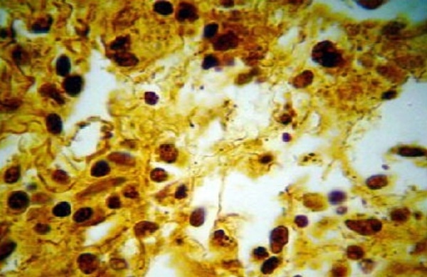 DETECCIÓN DE ILEITIS NECRÓTICA CAUSADA POR Lawsonia intracellularis EN PORCINOS DE GRANJAS TECNIFICADAS DE LA ZONA DE LIMA - Image 6