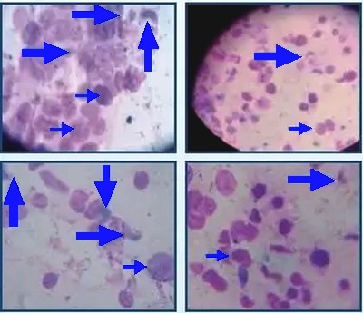 Enfermedades Intestinales: presencia de Isospora Suis en cerdos adultos - Image 2