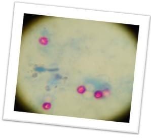 Cryptosporidium: causal de diarreas en terneros de tambo. - Image 1