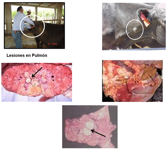 Prueba de Tuberculina