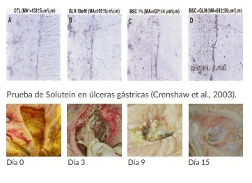 Impacto de las úlceras gástricas - Image 4