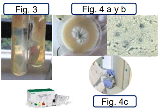 DETECCIÓN DEL ANTÍGENO DE GALACTOMANANO DE Aspergillus COMO MÉTODO DE SEGUIMIENTO TERAPÉUTICO EN LA ASPERGILOSIS NASAL CANINA: A PROPÓSITO DE UN CASO - Image 1