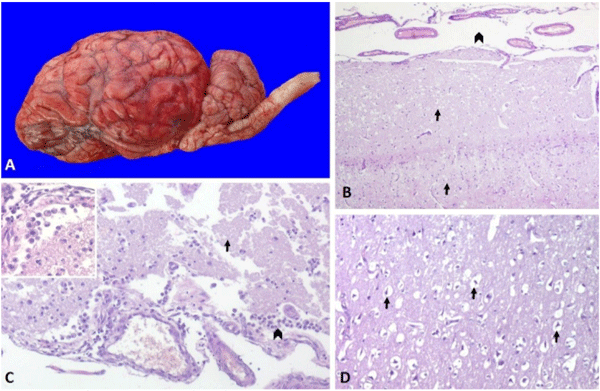 Figura 1. Polioencefalomalacia. A. Congestión meníngea y aplanamiento de las circunvoluciones cerebrales. B. Necrosis laminar cerebro-cortical (flechas) y edema sub-meníngeo (cabeza de flecha), H&E, 50×. C. Corteza cerebral: infiltrado de células Gitter (cabeza de flecha) y zonas de malacia en la capa molecular (flecha), H&E, 100×. Imagen inserta: células Gitter H&E, 400×. D. Corteza cerebral: condensación y retracción de somas neuronales (flechas), H&E, 400×.