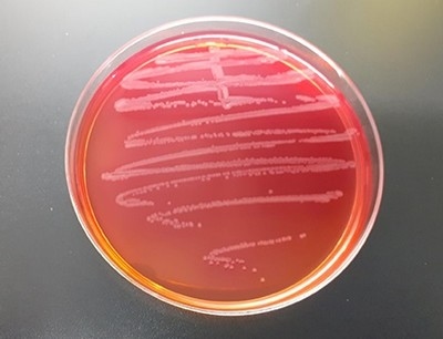 Diferenciación de cepas vacunales un factor esencial en el seguimiento y control de la salmonelosis en aves - Image 2