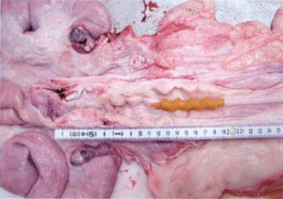 Foto 1: Posición del catéter en la Inseminación Artificial Convencional (IAC)