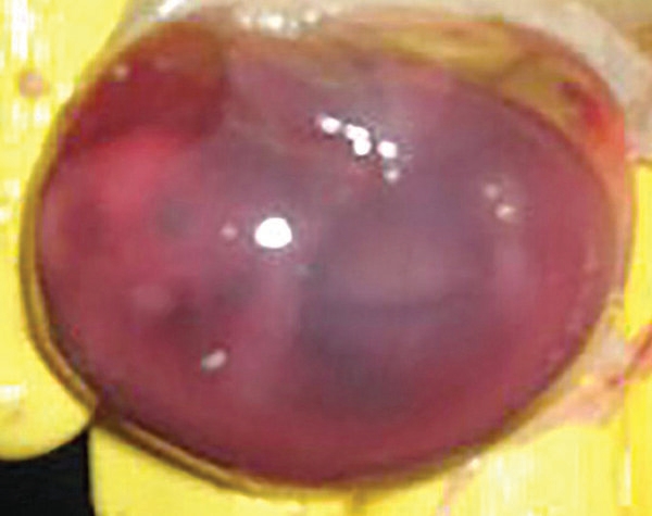 Caso de estudio: patología e histopatología como herramientas para el diagnóstico de trastornos reproductivos en cerdos relacionados con micotoxinas - Image 7