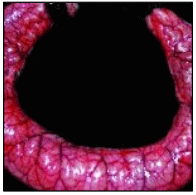 Figura 8. Se deben enviar porciones del intestino sin abrir y con los extremos anudados para un análisis microbiológico en caso de diarrea o presencia de lesiones entéricas.