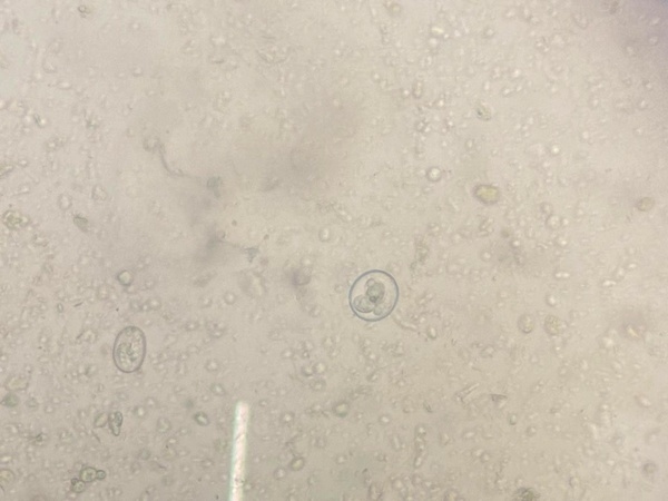 Coccidiosis Aviar. La enfermedad que genera las mayores pérdidas económicas de la industria avícola requiere nuevas estrategias de control - Image 1