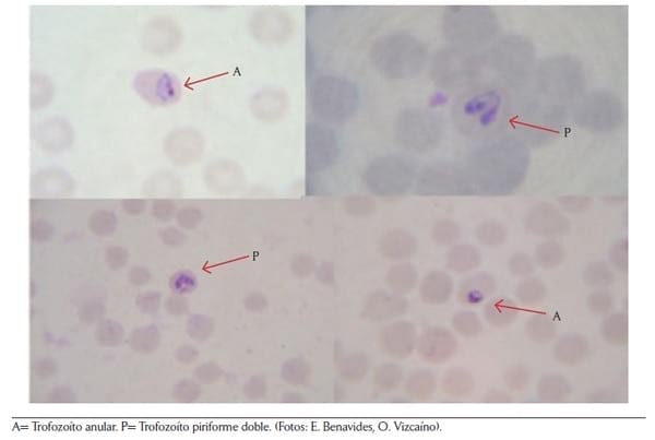 Criterios y protocolos para el diagnóstico de hemoparásitos en bovinos - Image 2