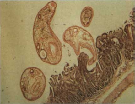 Cotylophoron cotylophorum: revisión de aspectos generales como medida inicial para implementar programas de control. - Image 14