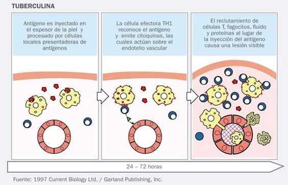 La prueba de tuberculina - Image 1