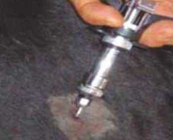 La prueba de tuberculina - Image 3