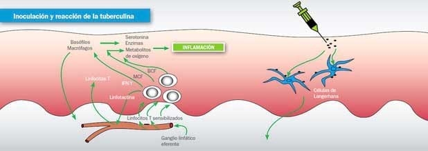 Tuberculosis: Amenaza en la salud y productividad de los Bovinos - Image 3