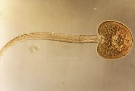 Fasciola hepatica en el ganado - Image 4