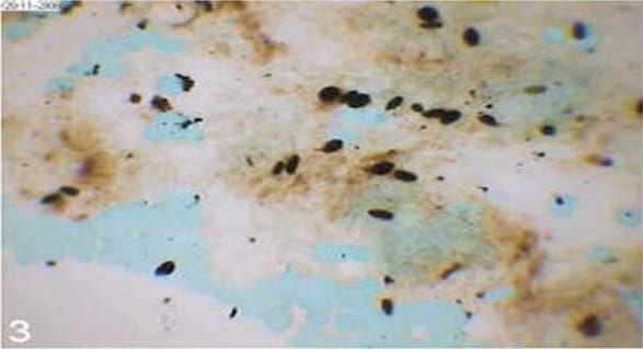 Esporotricosis en un gato doméstico - Image 2