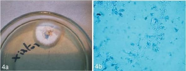 Esporotricosis en un gato doméstico - Image 3