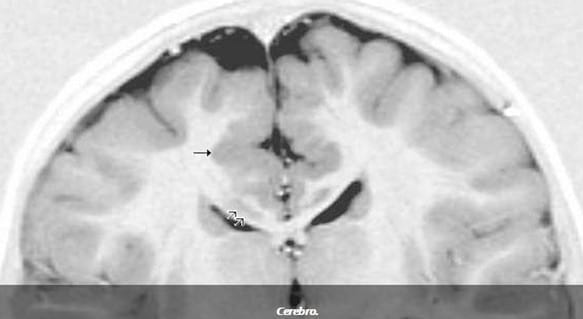 La epilepsia canina - Image 1