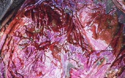 Fotografía 14. Hiperemia en la mucosa del abomaso (Perusia, O. y Rodríguez Armesto, R., 2017). Fuente: Herrera, J. 2019. Ilustración didáctica.