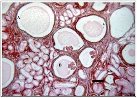 Enfermedad glomeruloquística en dos perros con insuficiencia renal - Image 2