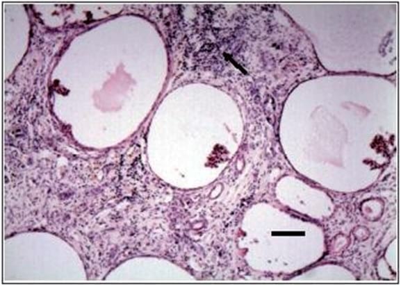Enfermedad glomeruloquística en dos perros con insuficiencia renal - Image 3