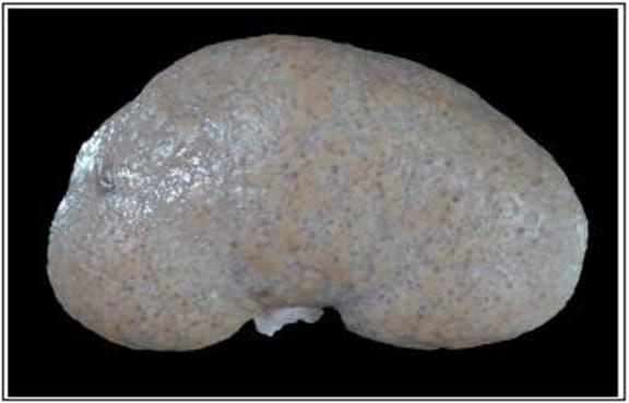 Enfermedad glomeruloquística en dos perros con insuficiencia renal - Image 1