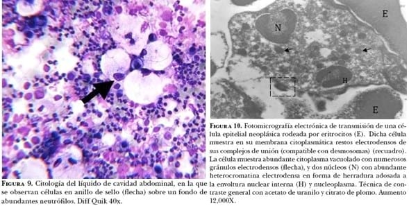 Carcinoma prostático en perro. Informe de un caso - Image 5