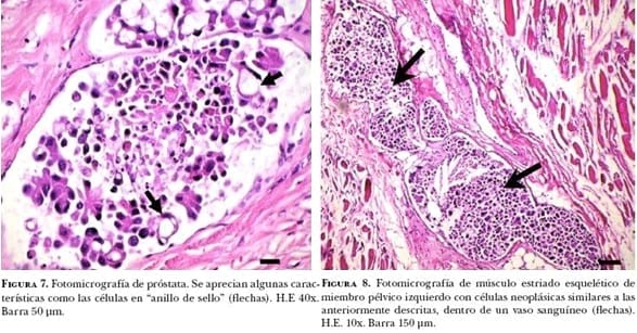 Carcinoma prostático en perro. Informe de un caso - Image 4