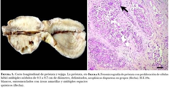 Carcinoma prostático en perro. Informe de un caso - Image 3
