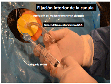 Producción de energía a partir de los gases ruminales del bovino - Image 15