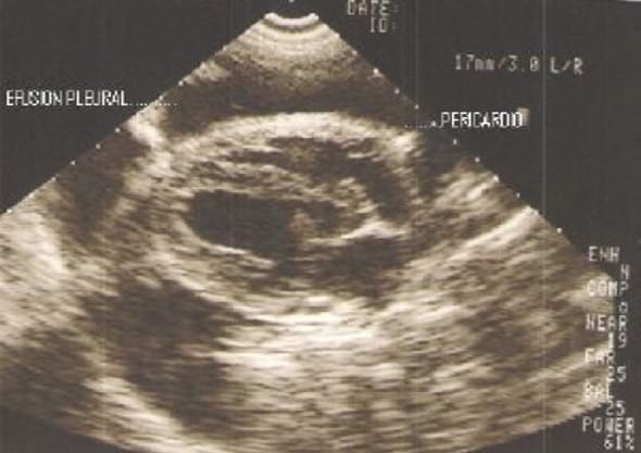Pericarditis constrictiva con efusión pleural recurrente en un perro: reporte de caso - Image 1