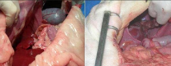 Presentación de un caso de: Hernia Diafragmática Peritoneo-Pericardica - Image 2