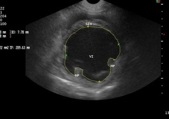 Caso Clínico: Cardiomiopatia Dilatada Canina Con Fibrilacion Atrial - Image 1