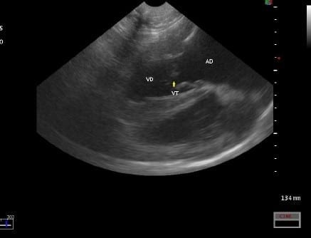 Caso Clínico: Displasia Valvular Tricuspide Congenita en un Dogo De Burdeos - Image 4