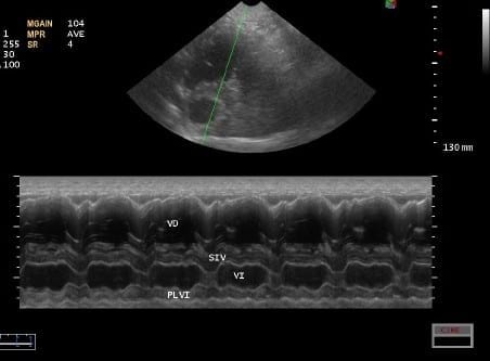 Caso Clínico: Displasia Valvular Tricuspide Congenita en un Dogo De Burdeos - Image 5