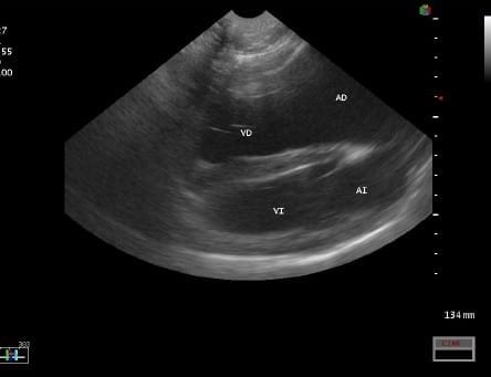 Caso Clínico: Displasia Valvular Tricuspide Congenita en un Dogo De Burdeos - Image 3