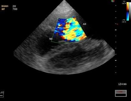 Caso Clínico: Displasia Valvular Tricuspide Congenita en un Dogo De Burdeos - Image 6